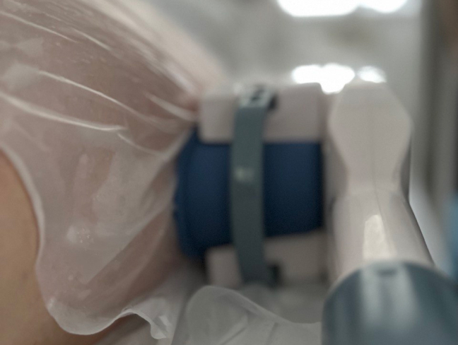 Консультація стоматолога-ортодонта Ірпінь