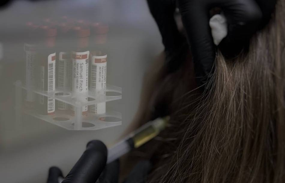 Трихолог. плазмотерапия