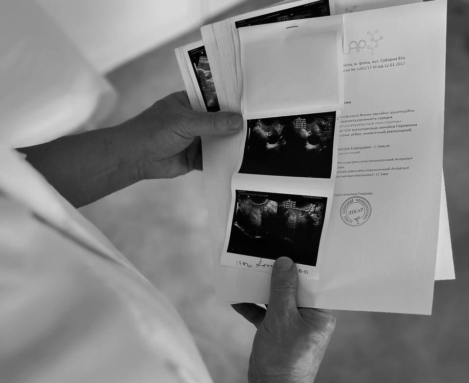 УЗИ в Ирпене Ультразвукова діагностика