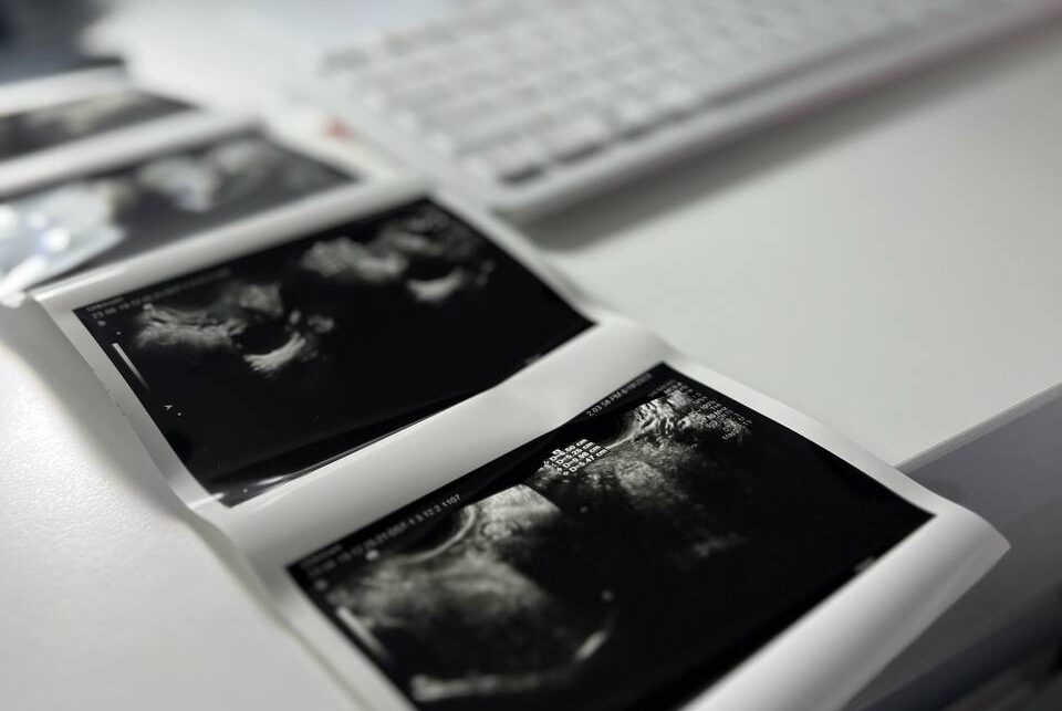 Ультразвукова діагностика