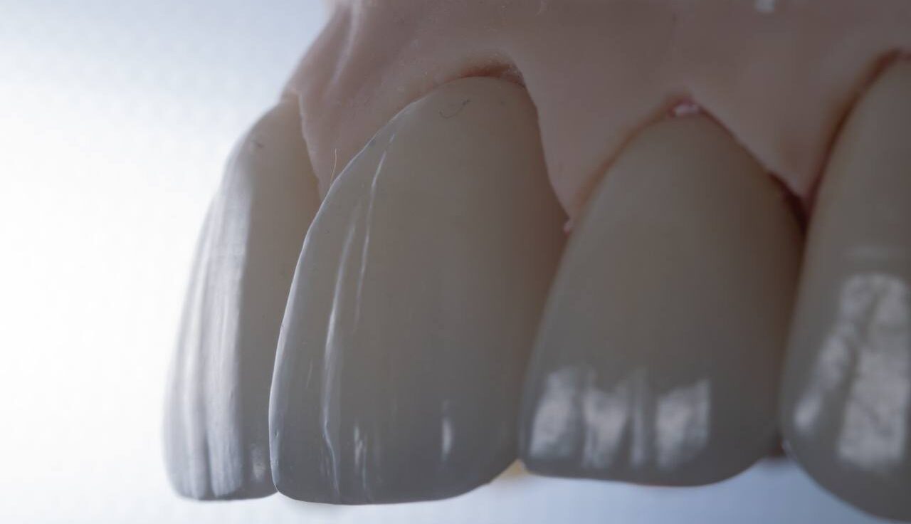 Стоматология в Ирпене Стоматологія в Ірпені