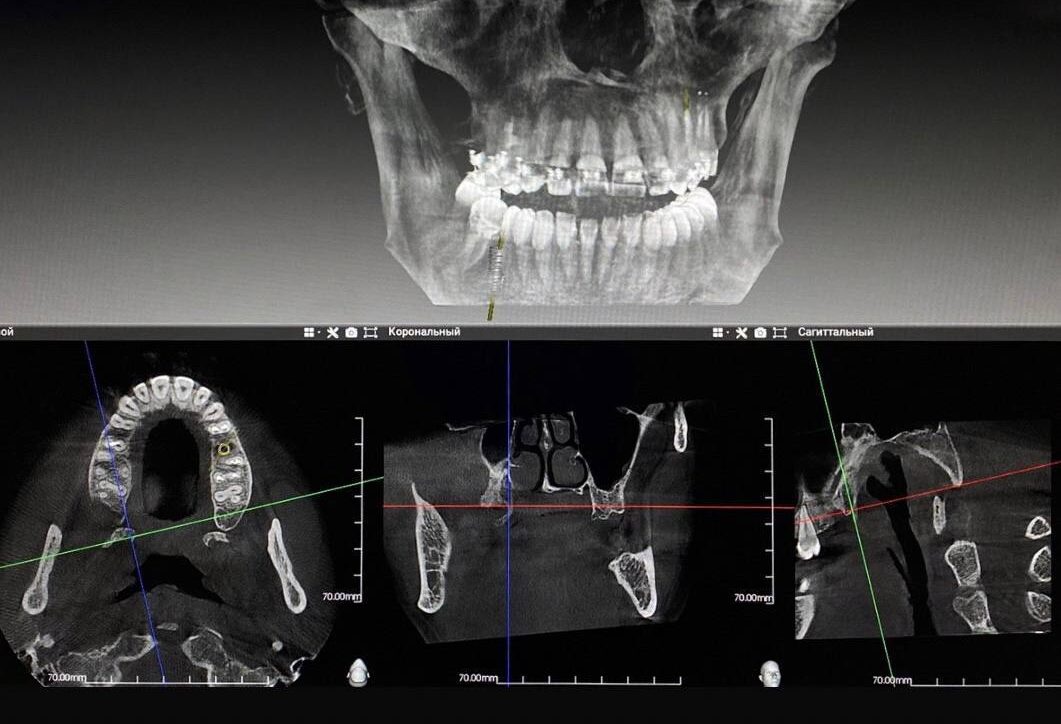 Стоматология в Ирпене Стоматологія в Ірпені