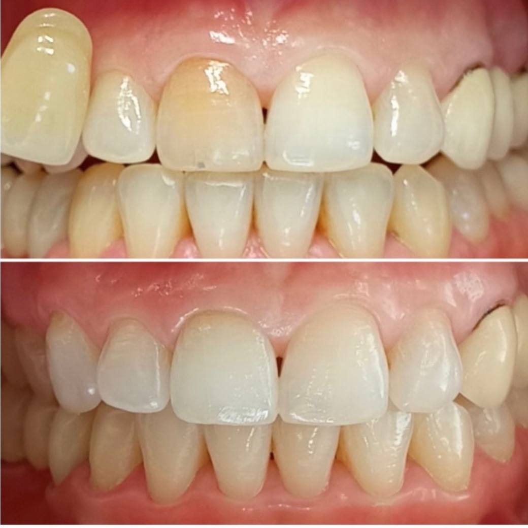 Стоматология в Ирпене Стоматологія в Ірпені