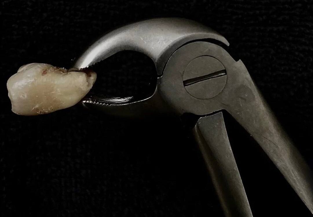 Стоматология в Ирпене Стоматологія в Ірпені