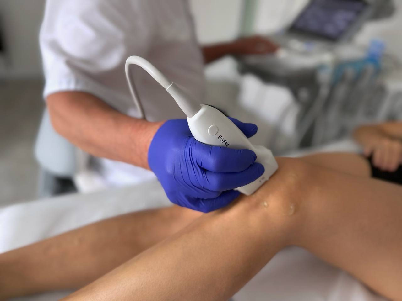 Ультразвукова діагностика