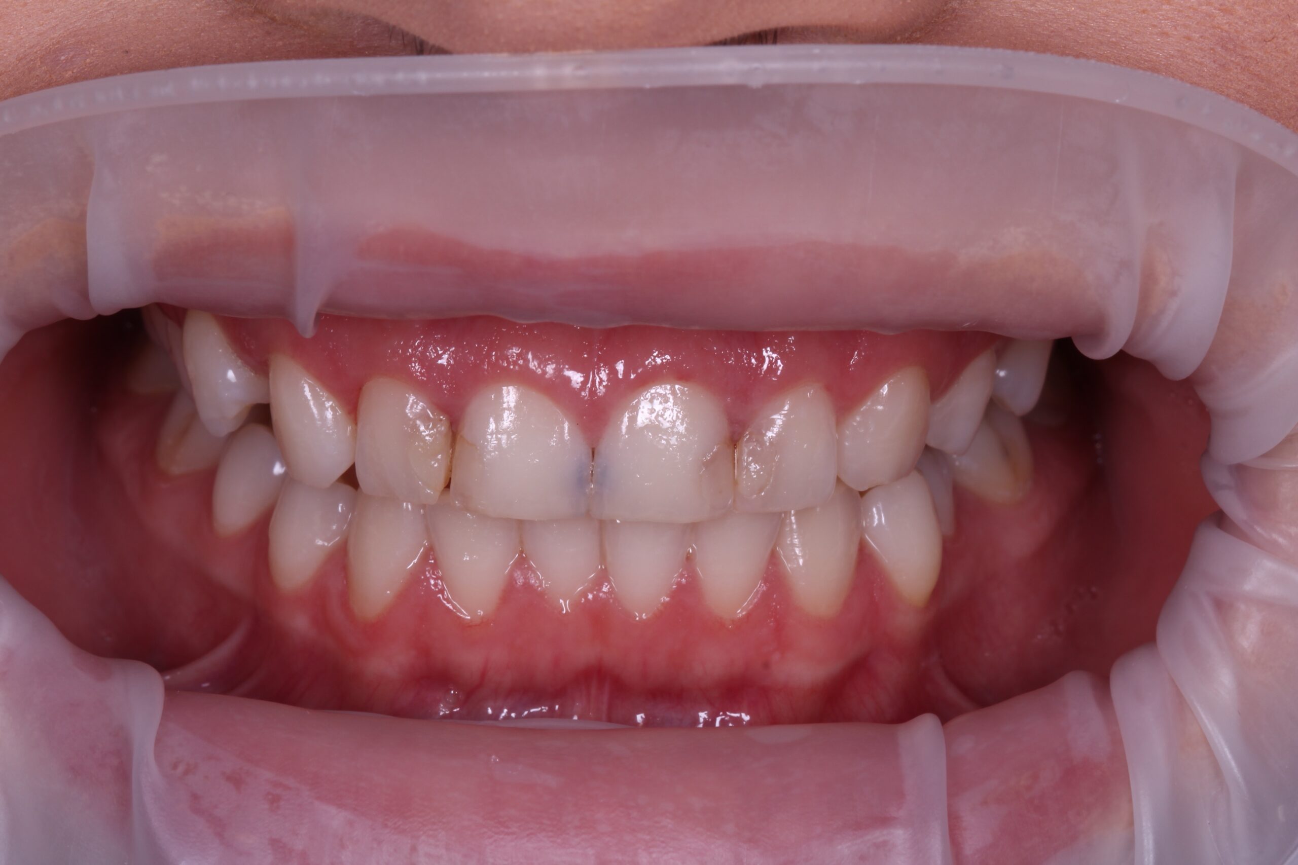 img_1339_20230610-150646