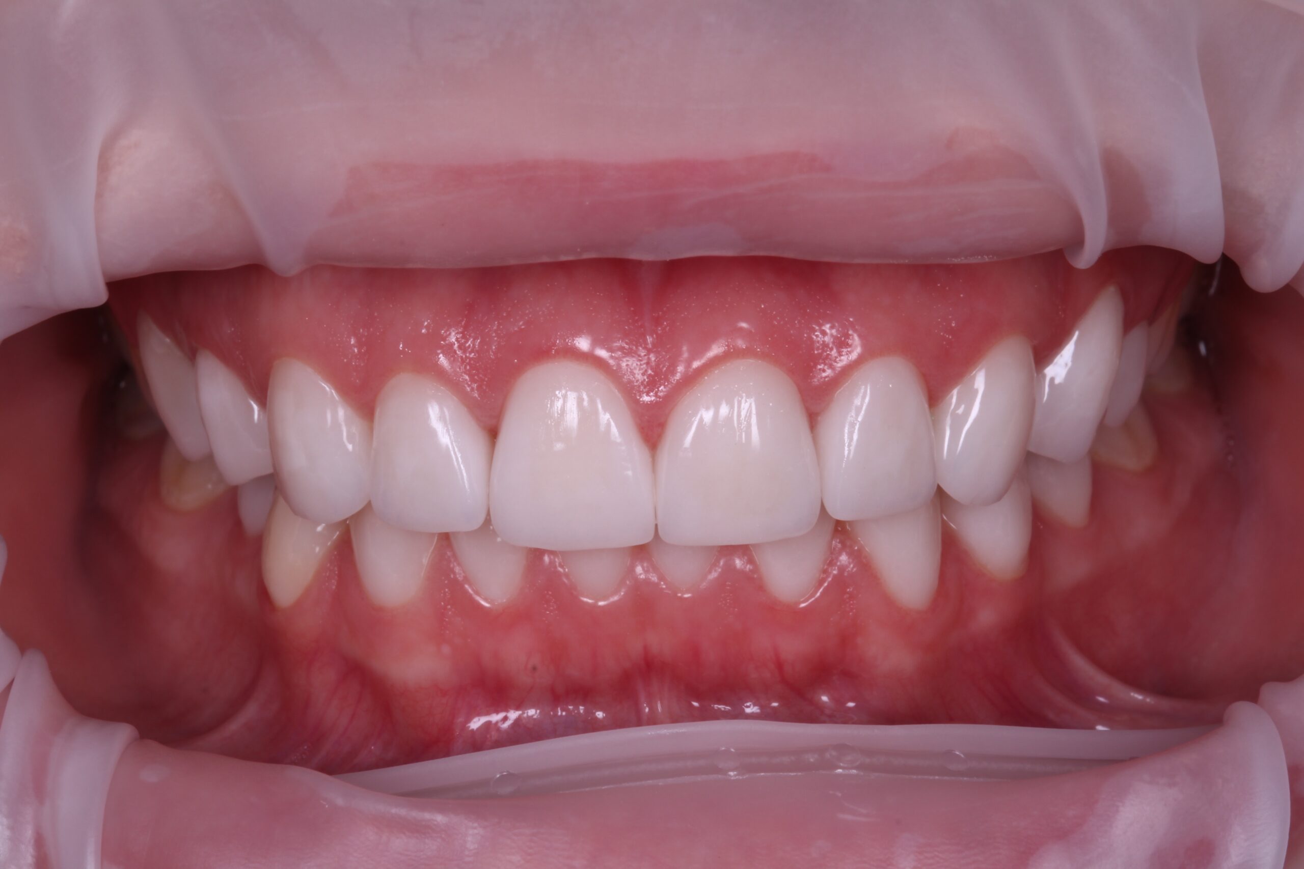 img_6664_20230701-161317