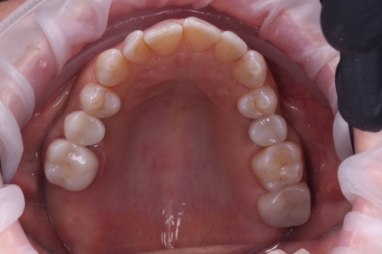 photo_5352954622068771868_y