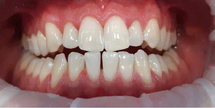 photo_5352954622068772002_x