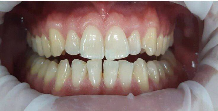 photo_5352954622068772003_x