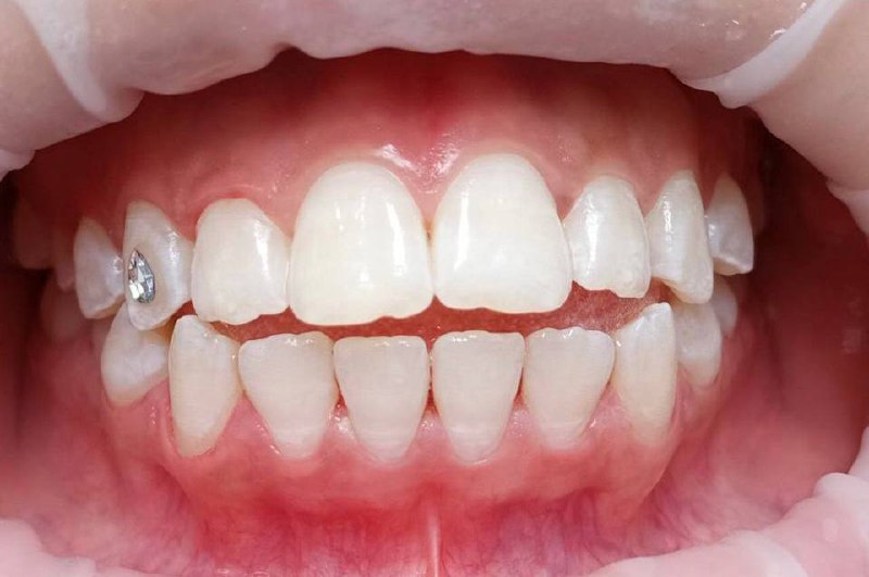 photo_5352954622068772004_x