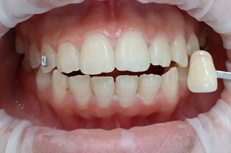 photo_5352954622068772005_x