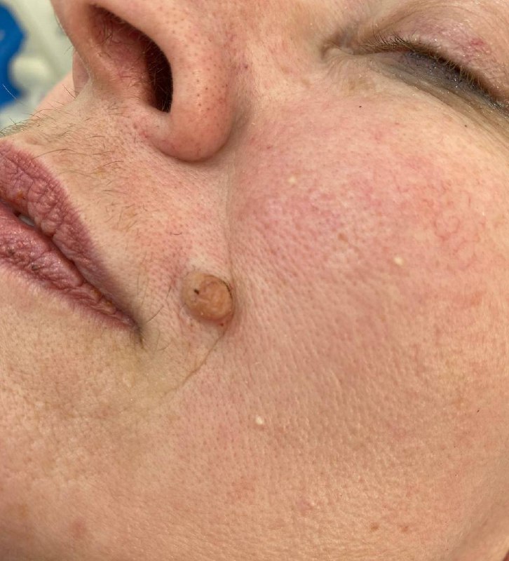 photo_5352954622068772026_x