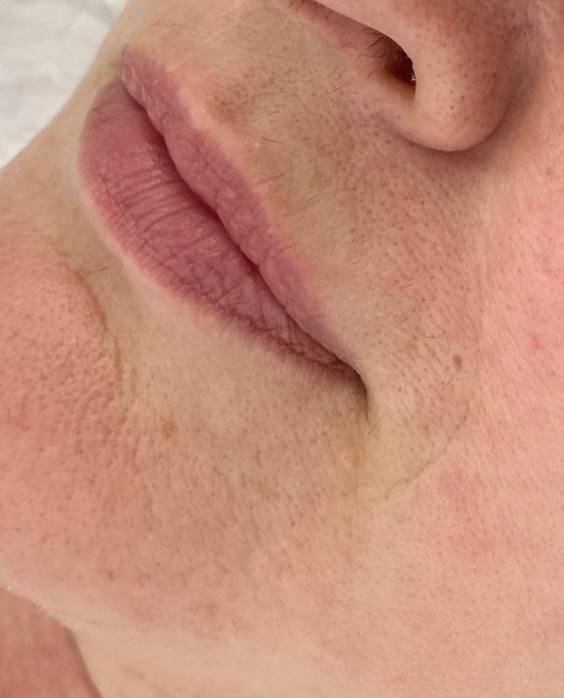 photo_5352954622068772027_x