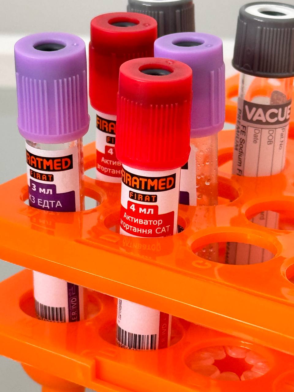 Забір аналізів в Ірпені