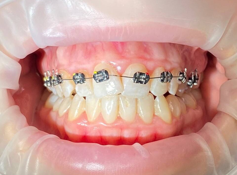 31aa180a-c278-4199-b980-33c9830d188b