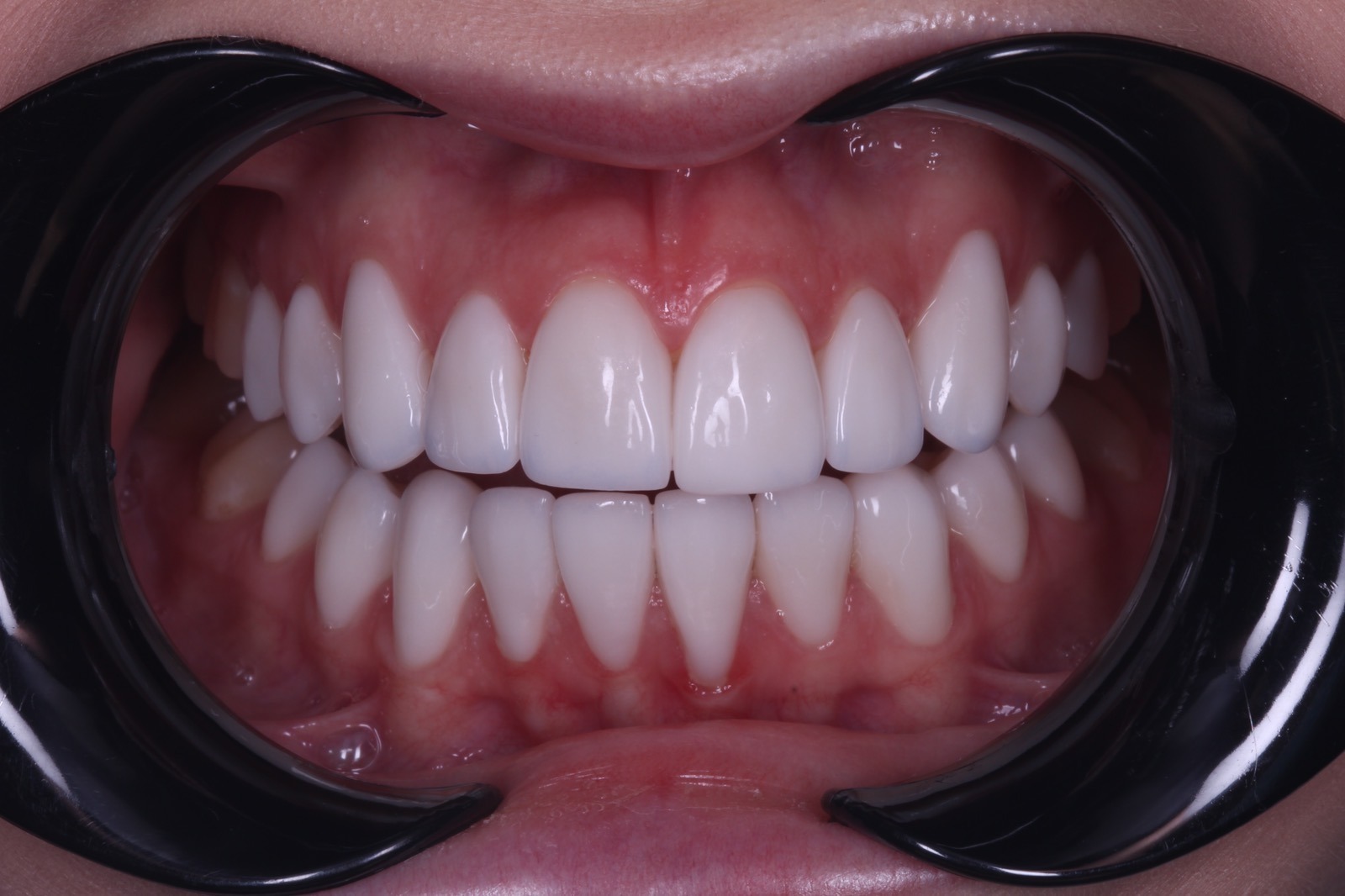 d861db3c-673b-4609-9e5e-7af2996604fc