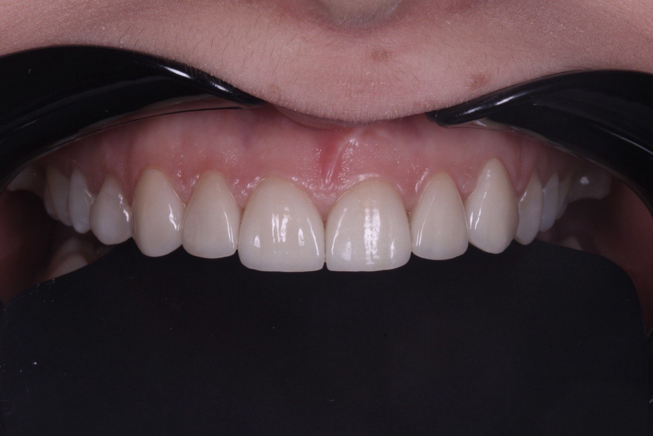 f078ba80-fd0e-452d-b6a8-351da25b4e96