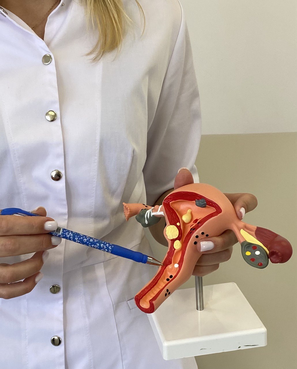 633eed6f-f7fa-416d-b13b-a2dd558c14b6